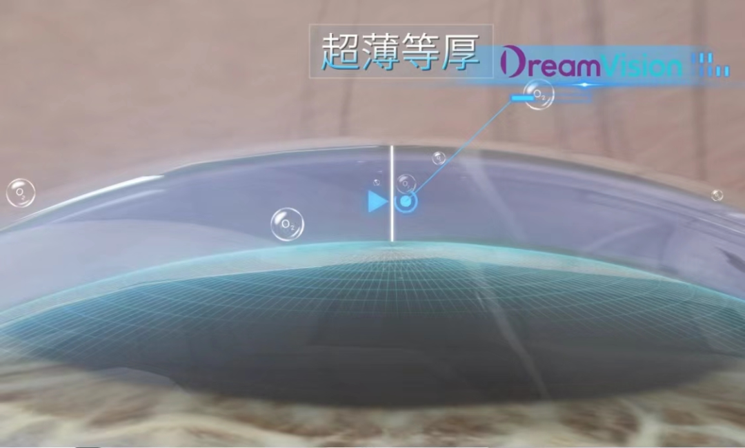 ����� | �ٷ���վ