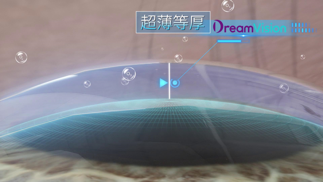 ����� | �ٷ���վ